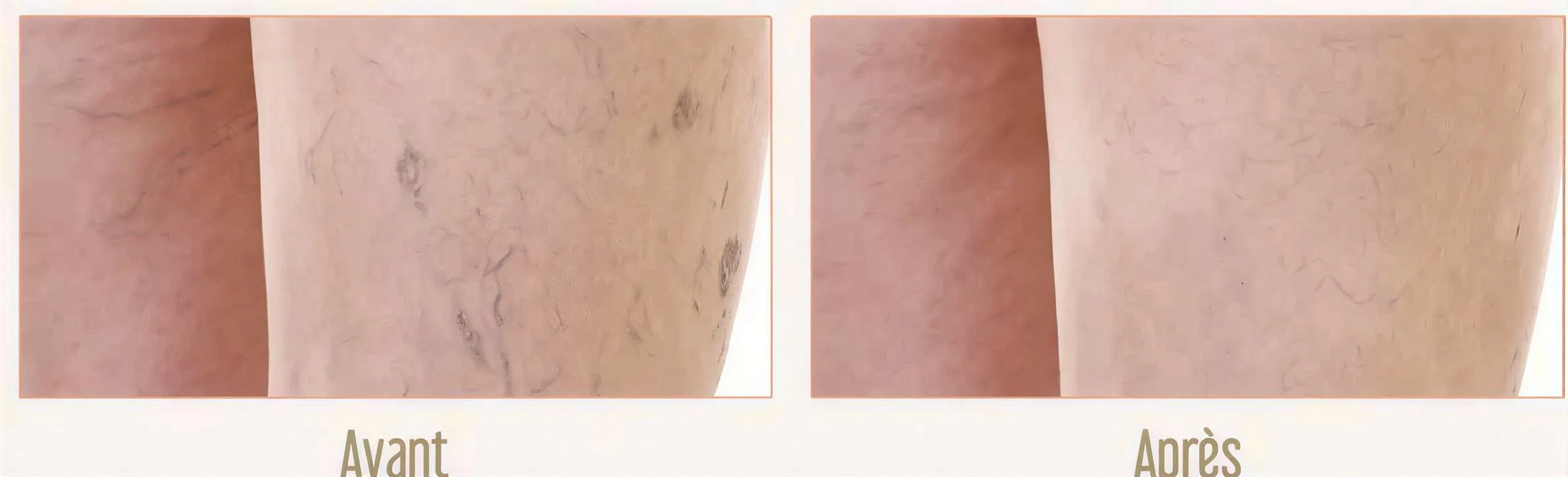 Efficacité Médicale